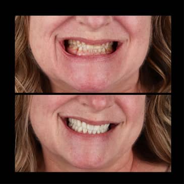 Slider image (6) The Dental Corner